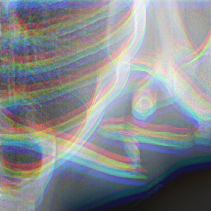 Overdensities Naked Passion