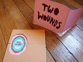 Two Wounds photo 