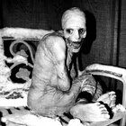 COPROCEPHALIC - Gluttonous Chunks | Coprocephalic | Inherited
