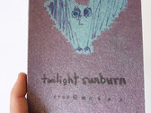 Twilight Sunburn photo 