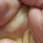Shmemli thumbnail