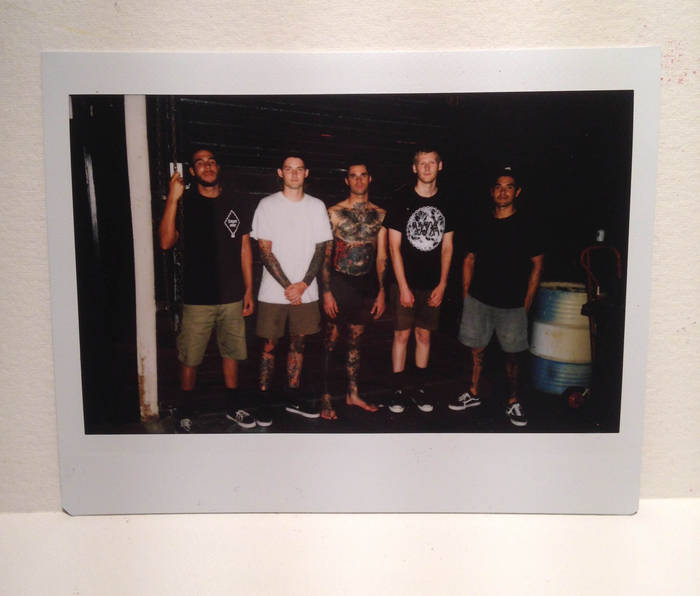 Music | Nerve Damage