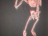 Skeleton photo 