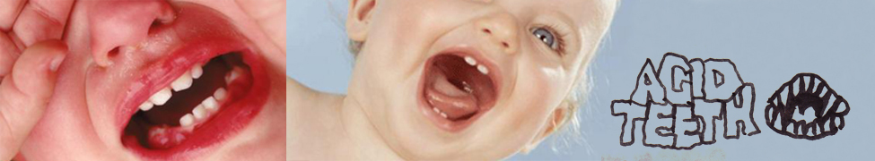 Acid Teeth — Photo