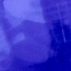 Gardenback thumbnail