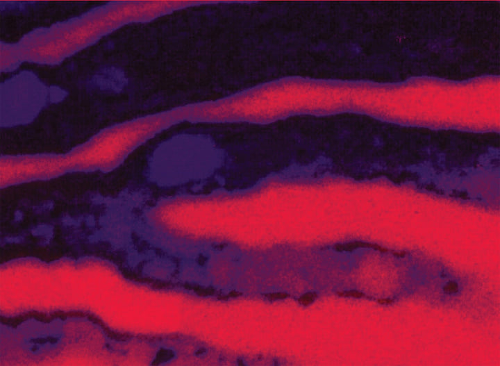 【美品】acid 2005-2007 CD＋DVD ACID ACID | ACID ACID | Acid Acid