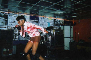 The Shock Deformity and Amputee — Photo · live_stage