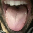 yotzfurman thumbnail