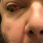Seán Croutón thumbnail