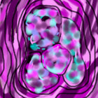PyrrhicCynthus thumbnail