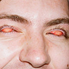 nkram thumbnail