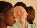 Tanzania Albinism Collective image