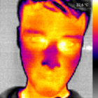 vipitis thumbnail