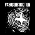 Vasoconstriction image