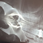 Travis Knutson thumbnail