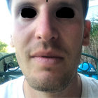 autchy thumbnail