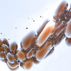 Medulasa thumbnail