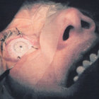 rippedcorpse thumbnail