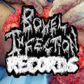 Bowel Infection Records image