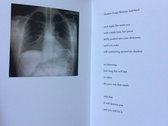 The SSRI Poems photo 