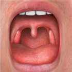 THROAT thumbnail