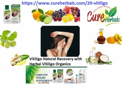 Recover Vitiligo with Natural Herbal Remedies main photo