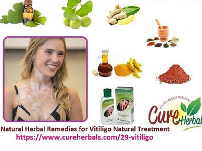 Get Rid of Vitiligo in Short Time with Natural Herbal Remedies main photo