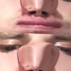 artem yy thumbnail