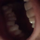 t_gilbot thumbnail