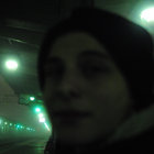 multilocular thumbnail