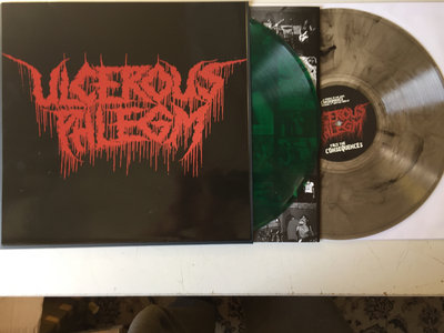 Merch | ULCEROUS PHLEGM