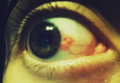 Decedent photo
