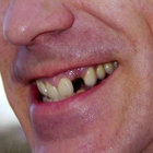 joao_rotten thumbnail