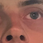 Gaffelstein thumbnail