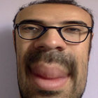 maximilliancasserole thumbnail
