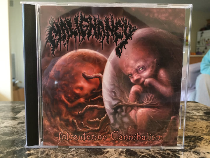 洋楽 MALIGNANCY/Intrauterine Cannibalism CD MALIGNANCY “Intrauterine Cannibalism” LP now available for