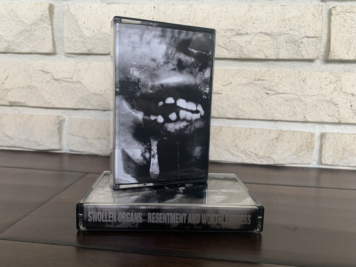 Resentment and Worthlessness | Swollen Organs | Phage Tapes