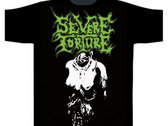 Merch | Severe Torture