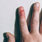 Samadhi thumbnail