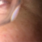 Pwillco thumbnail