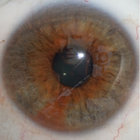 enginarer thumbnail
