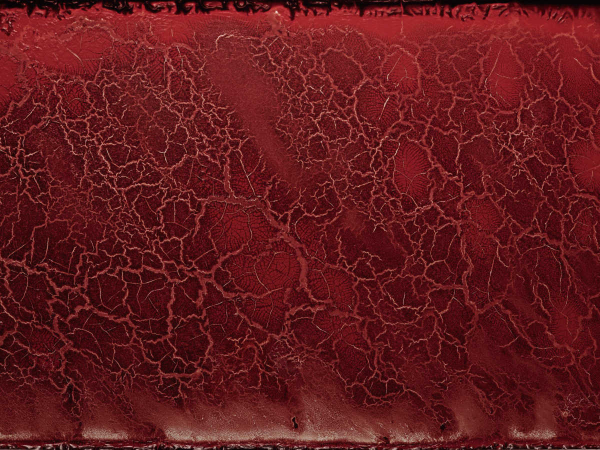 Blood Surgical Death Kandarivas