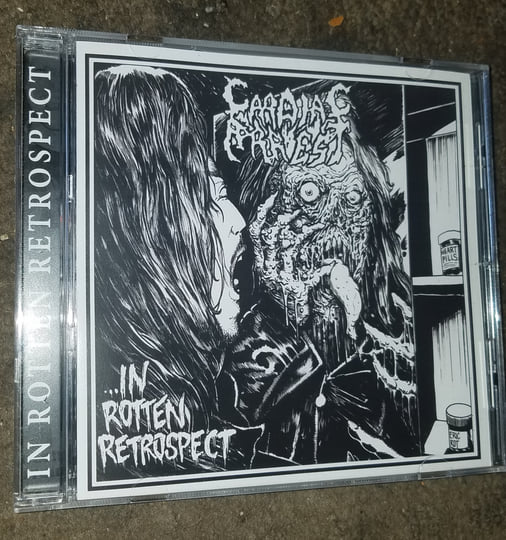 In Rotten Retrospect | Cardiac Arrest | SEVARED