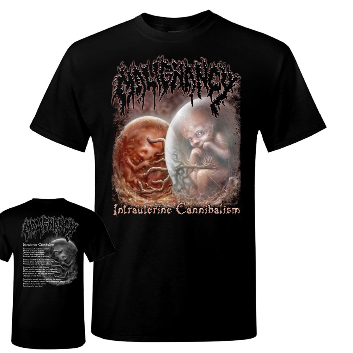 洋楽 MALIGNANCY/Intrauterine Cannibalism CD maxresdefault.jpg?sqp=-