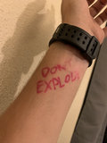 Don't Explode! image