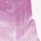 Lambeth thumbnail