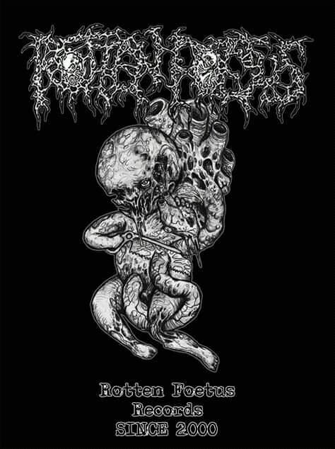 LYMPHATIC PHLEGM / PACREATITE NECRO HEMORRÁGICA: Split CD/EP