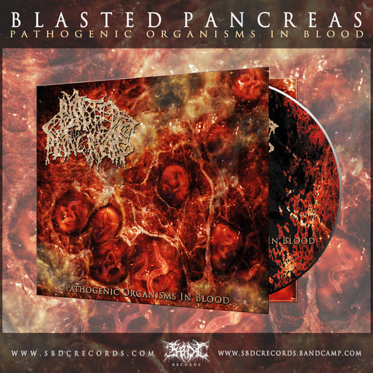 Pathogenic Organisms In Blood | Blasted Pancreas | SBDC Records