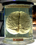 Varicose Brains image