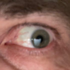 lo4nn thumbnail